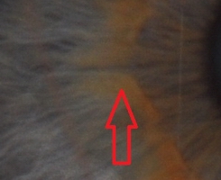 S 1