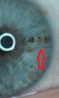 pigment